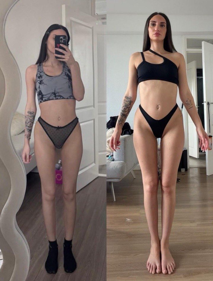 Cambio físico de Amanda: antes y después
